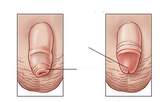 ¿Qué tarea hace lubricantes