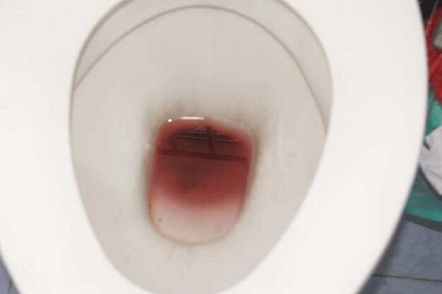 notar en los hombres cuando están excitados